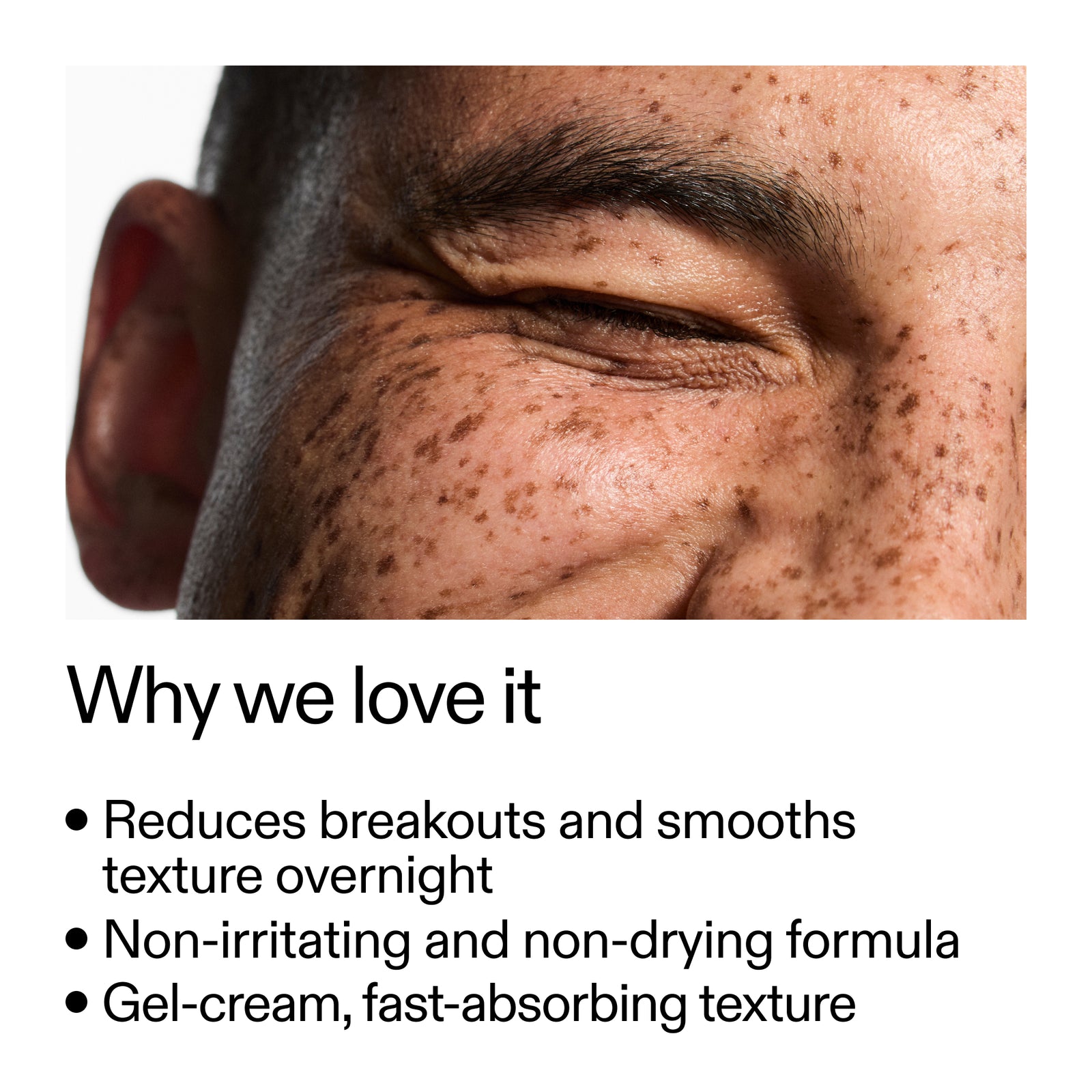 Key benefits of Blemish Clearing Moisturizer