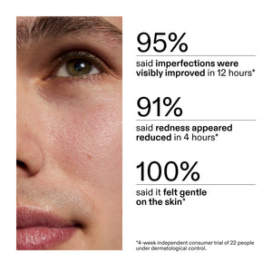 Close-up of a person's face with skincare product application, showing improvement statistics from clinical study after using Succinic Acid Treatment