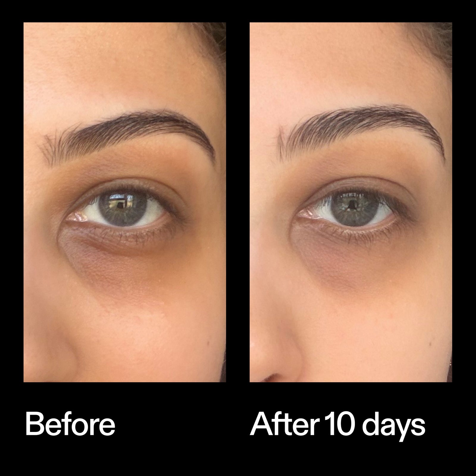 Before and after results using The INKEY List Caffeine Eye Cream after 10 days