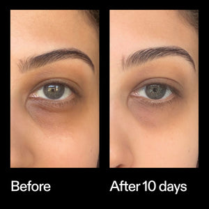 Before and after results using The INKEY List Caffeine Eye Cream after 10 days