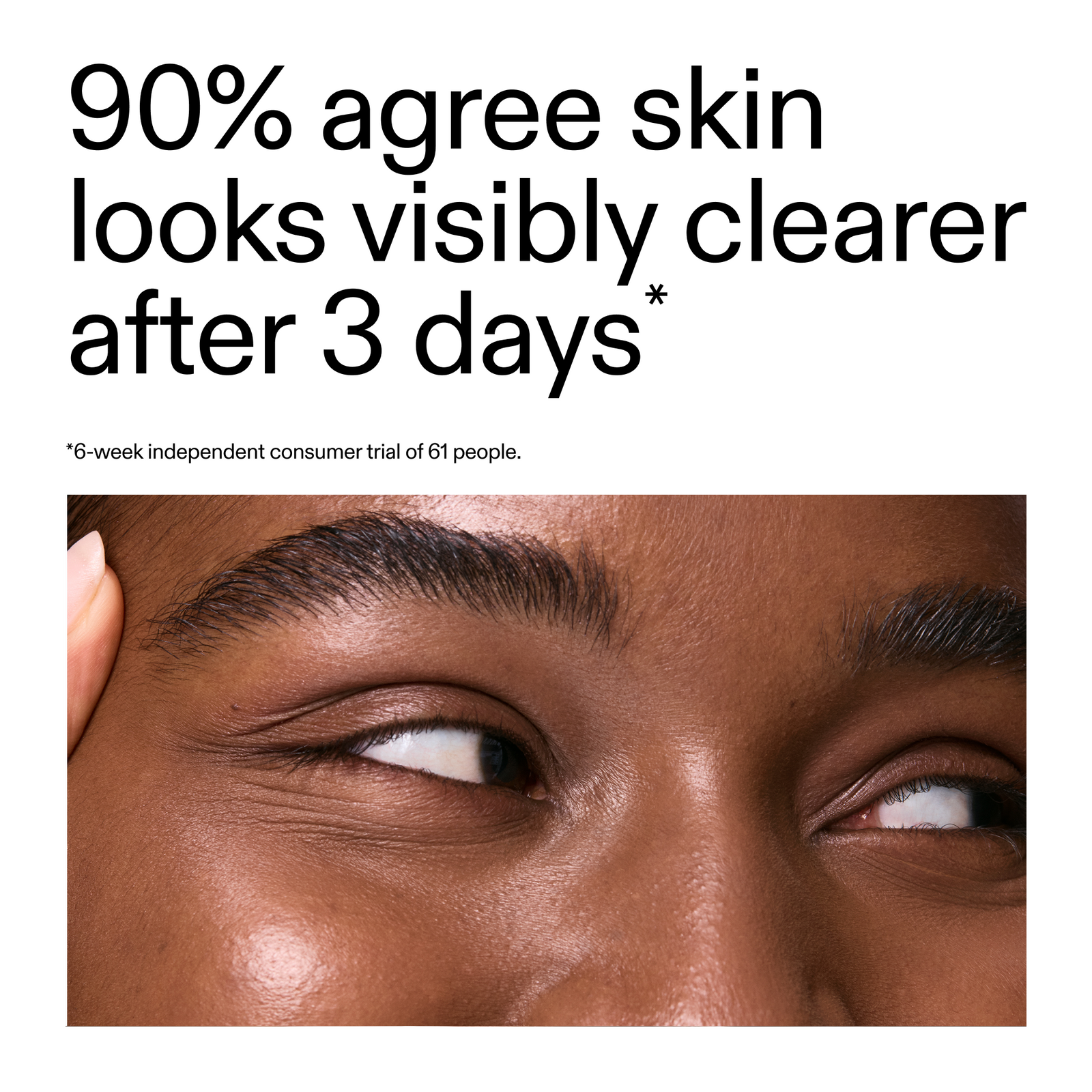  text about skin clarity improvement after 3 days, using Salicylic Acid Cleanser featuring a close-up of a person's eye.