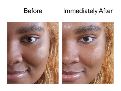 Before and after comparison of a person's face with visible skin texture differences.