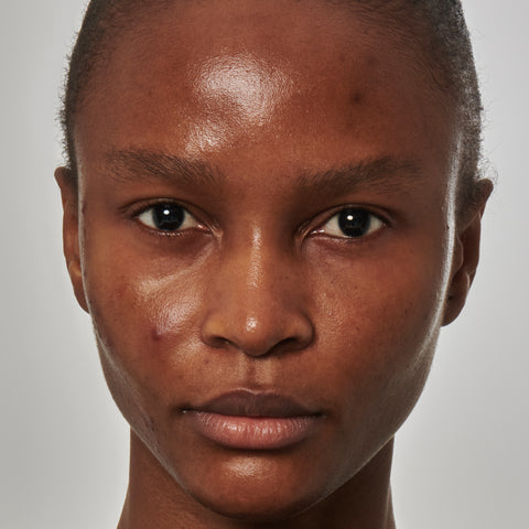 Model with excess oil on her face