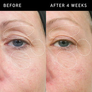 Before and after images to show Bio-Active Ceramide Repairing and Plumping Moisturiser results after 4 weeks