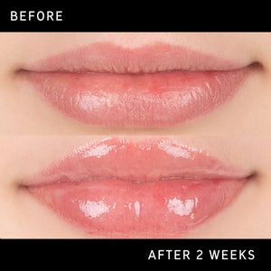 Two images of a pair of lips, put side by side to show the different after using Tripeptide Plumping Lip Balm for 2 weeks.