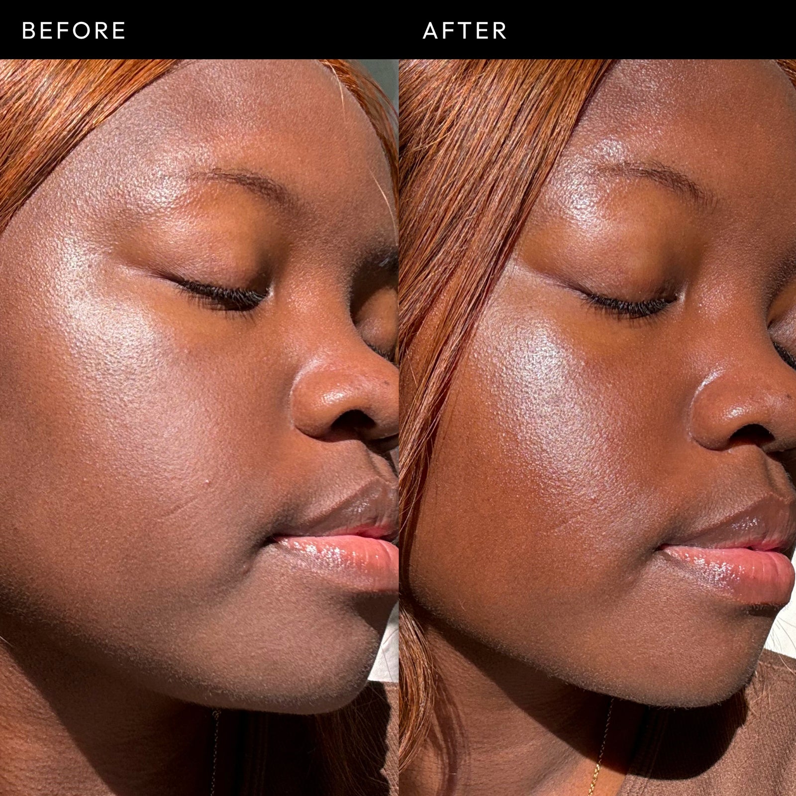 Exosome before and after showing glowing skin