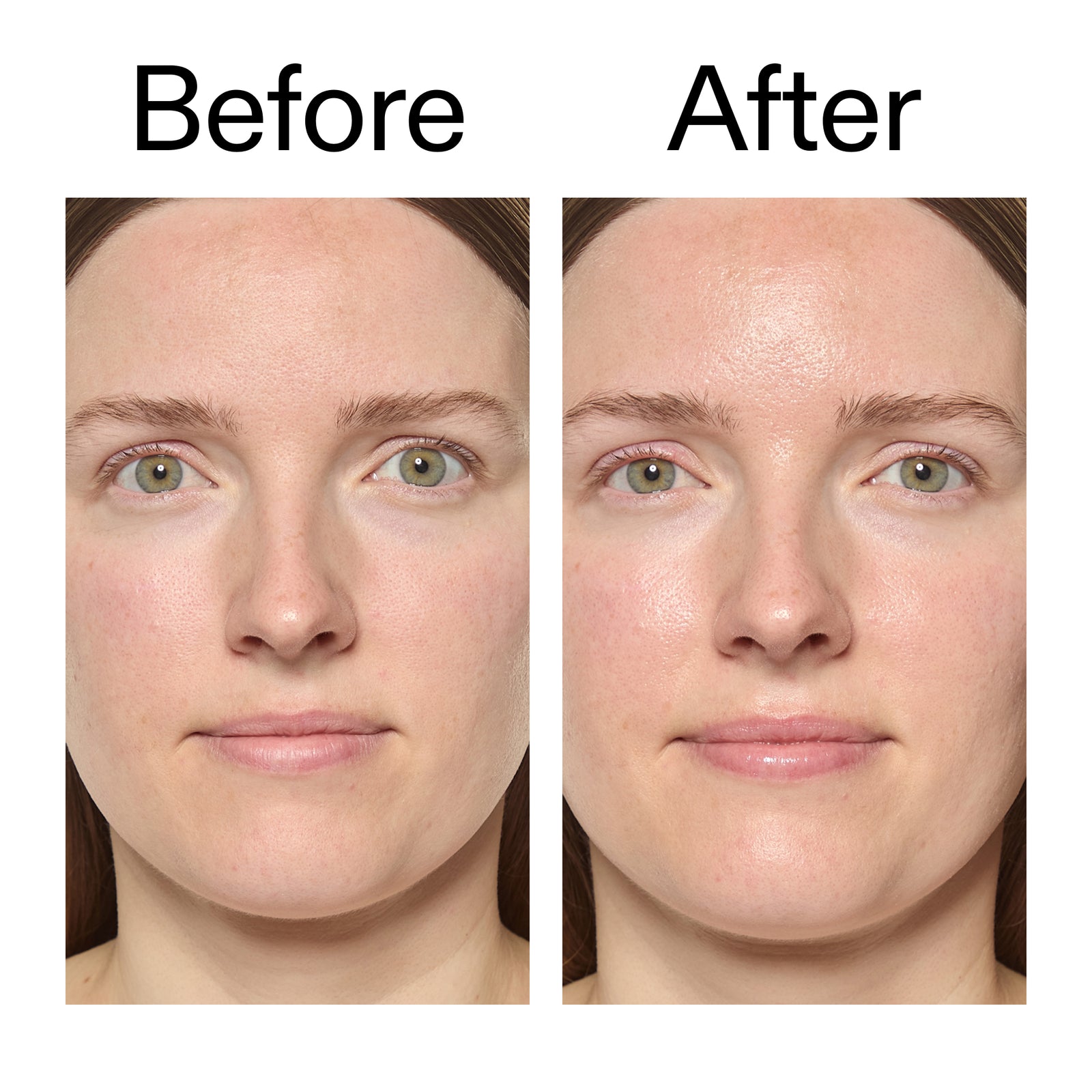 Before and after comparison of a woman's face with visible skin texture  adifferences after using Exosome Hydro-Glow Complex