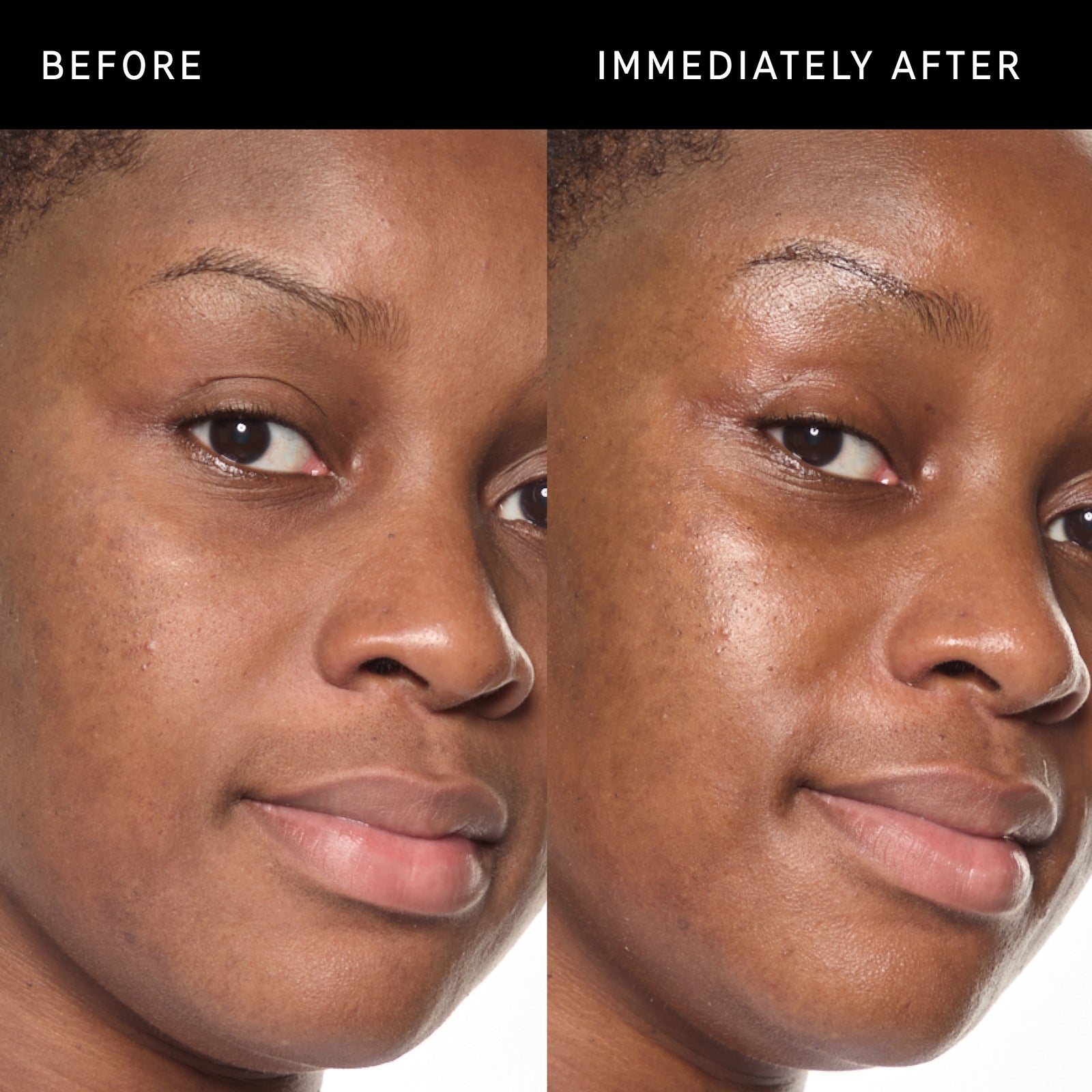 B&A showing smoother skin