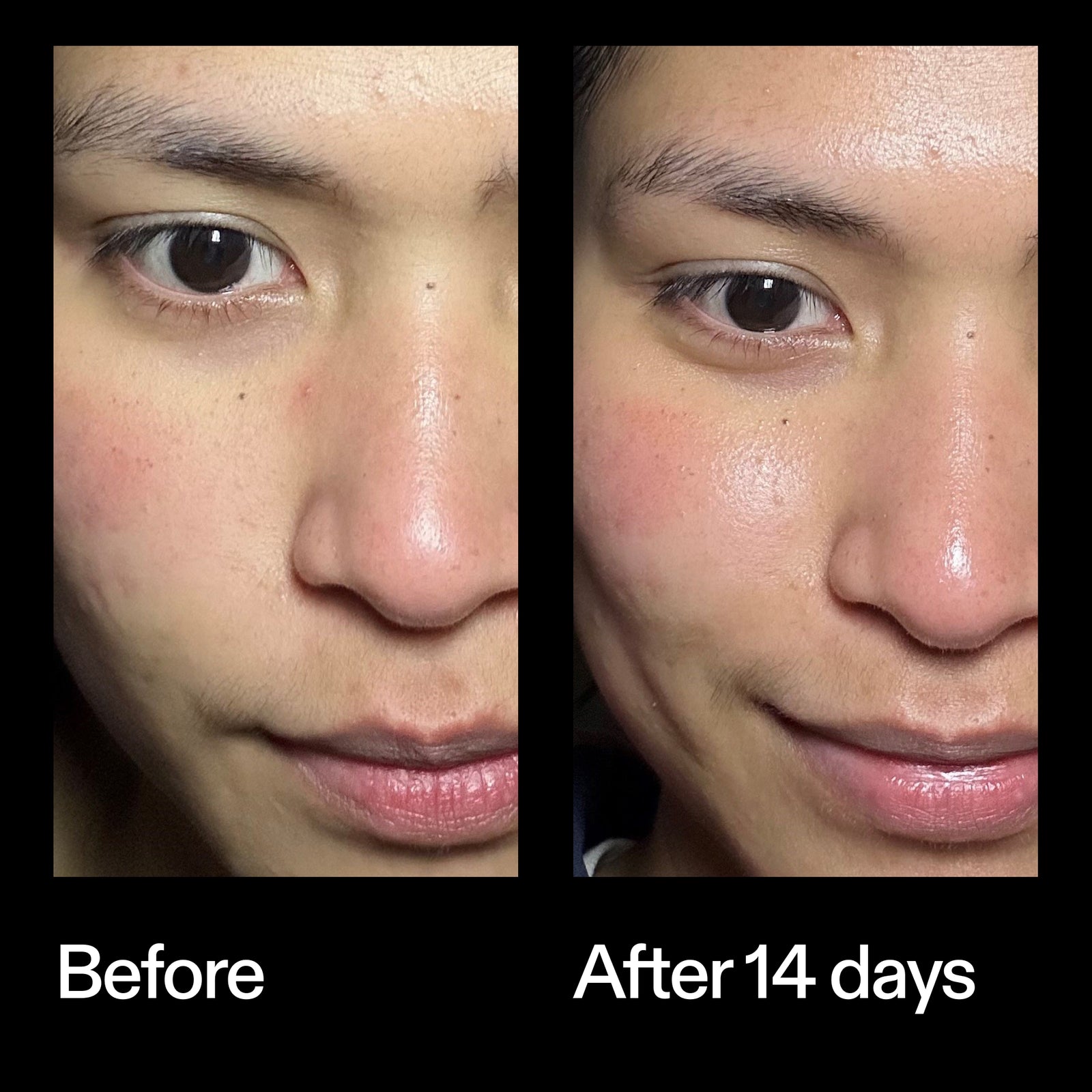Before and after results using The INKEY List Exosome Hydro-Glow Complex after 14 days