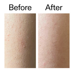 Before and after comparison of skin texture on a white background
