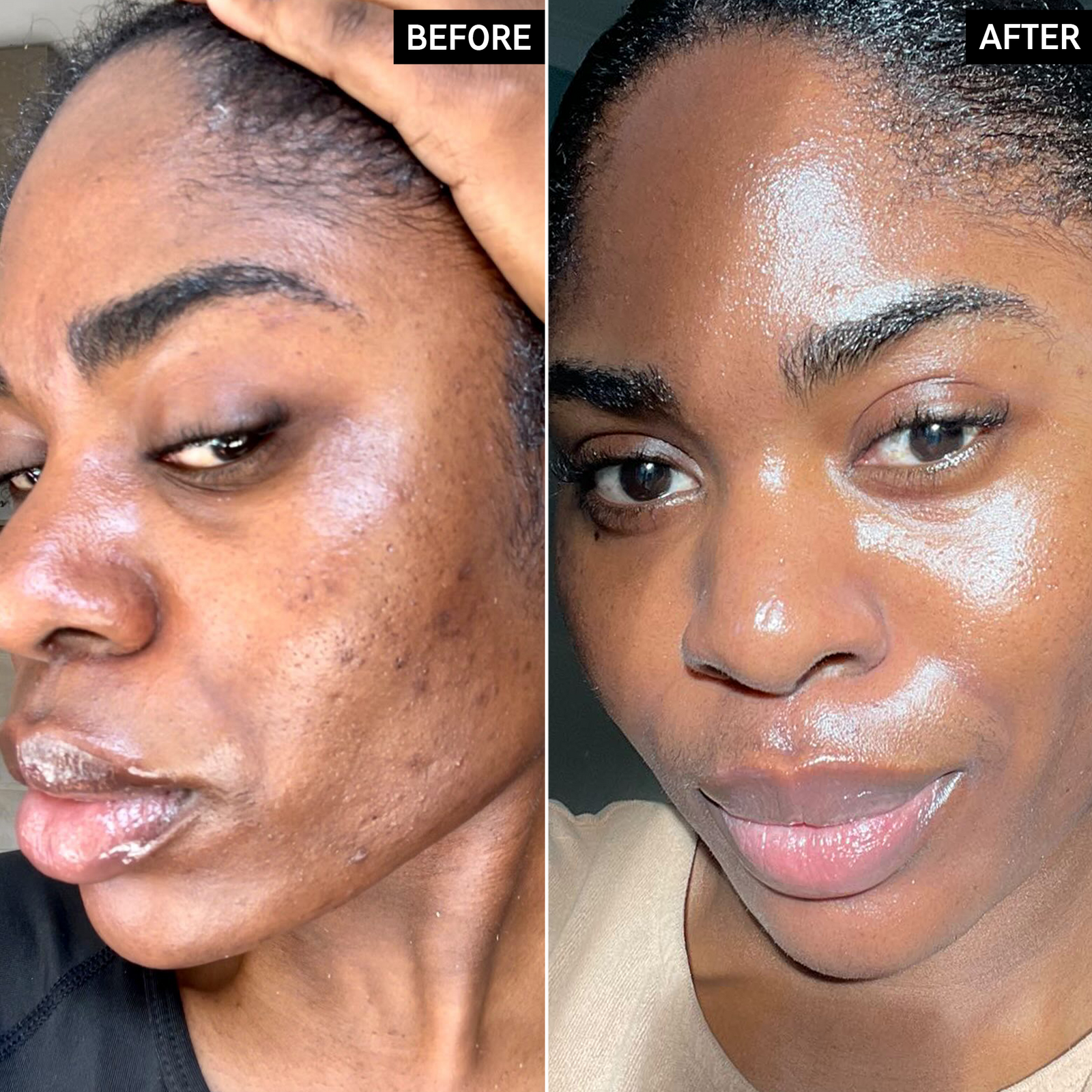 Before and after of an INKEY customer using Omega Water Cream. 