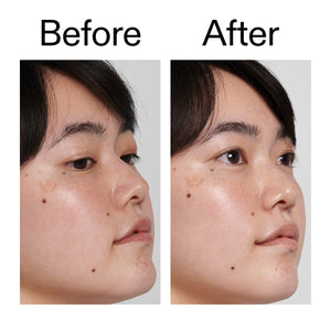 Before and after using Hyaluronic Acid Cleanser