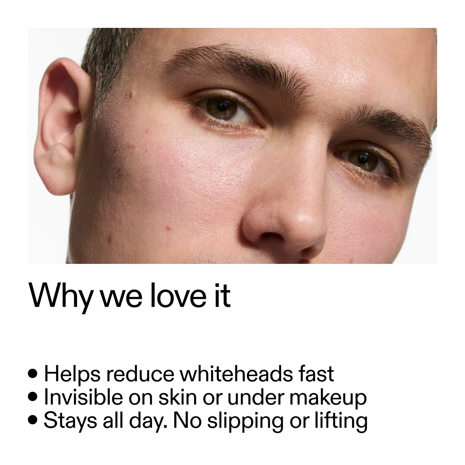 Close-up of a person's face with text highlighting Hydrocolloid Invisible Pimple Patches  benefits on a white background
