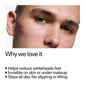 Close-up of a person's face with text highlighting Hydrocolloid Invisible Pimple Patches  benefits on a white background