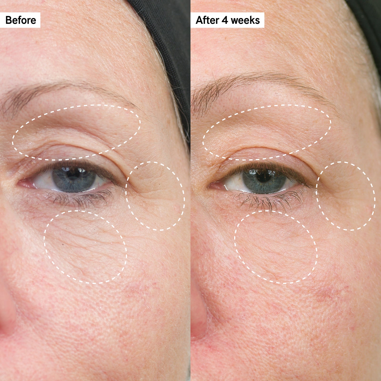 Before and after images to show Bio-Active Ceramide Repairing and Plumping Moisturiser results after 4 weeks