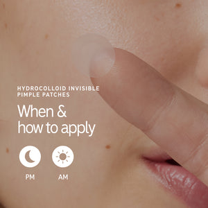 When and how to use Pimple Patches