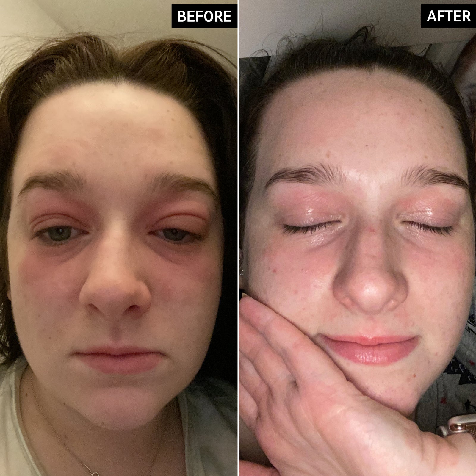 UGC Oat Cleansing Balm before and after image