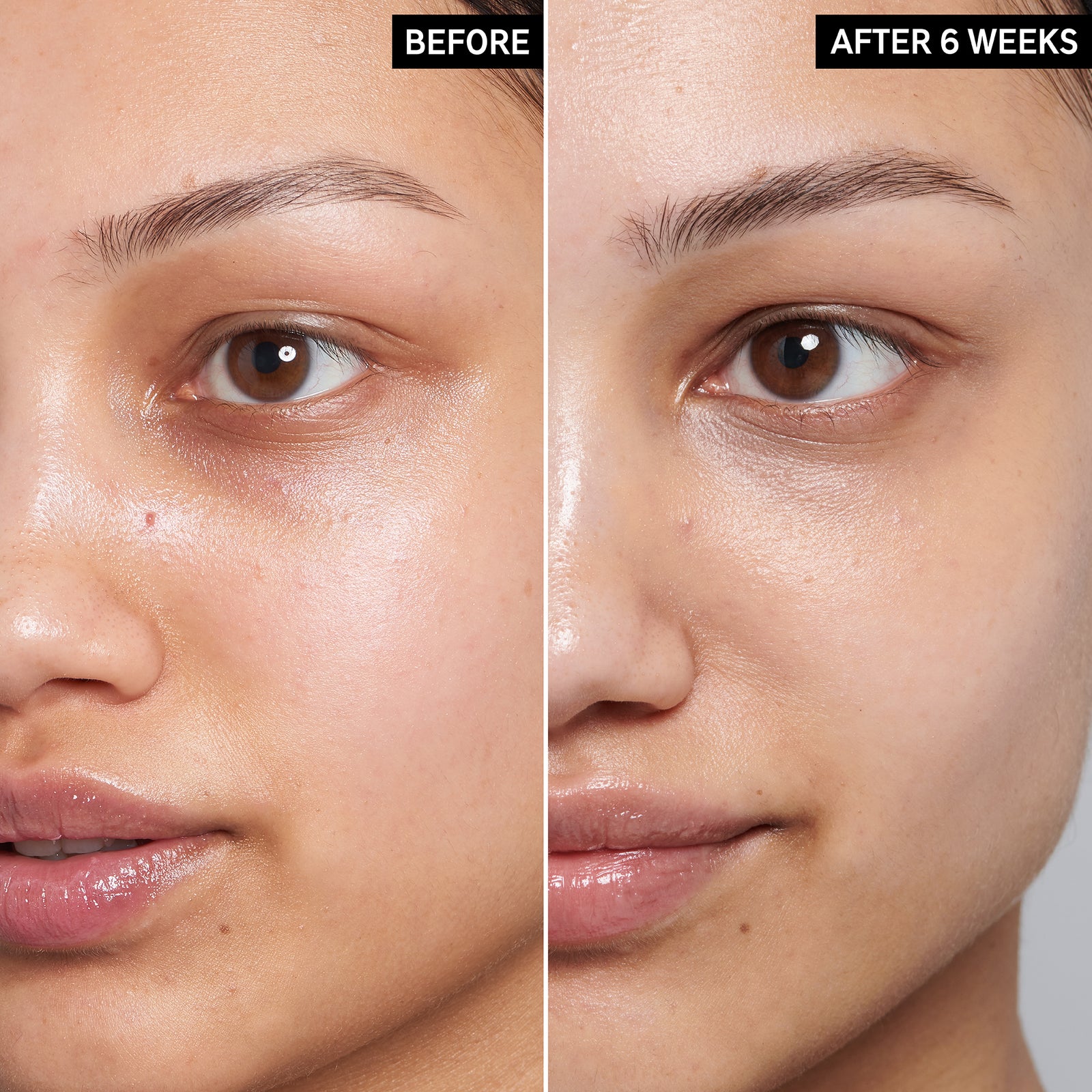 Before and After using Caffeine Eye Cream for 6 weeks
