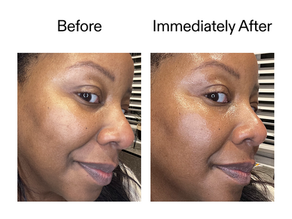 Before and after comparison of a woman's face with visible skin texture differences.