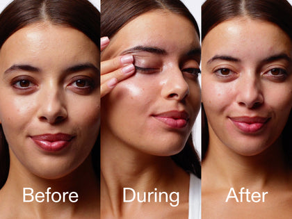 Before, During, and After comparison of a woman's face with skincare product application.
