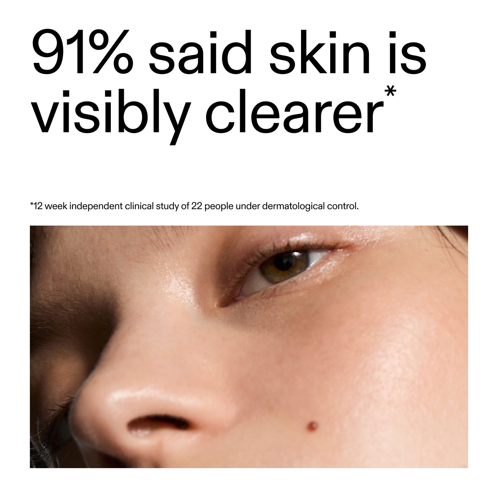 Close-up of a person's eye with text indicating skin clarity improvement after using Blemish Clearing Moisturiser with 2% Novoretin
