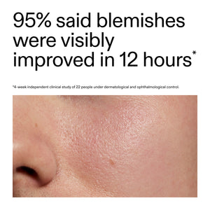 Advertisement showing a close-up of skin with blemishes and text about improvement in 12 hours after using Succinic Acid Treatment