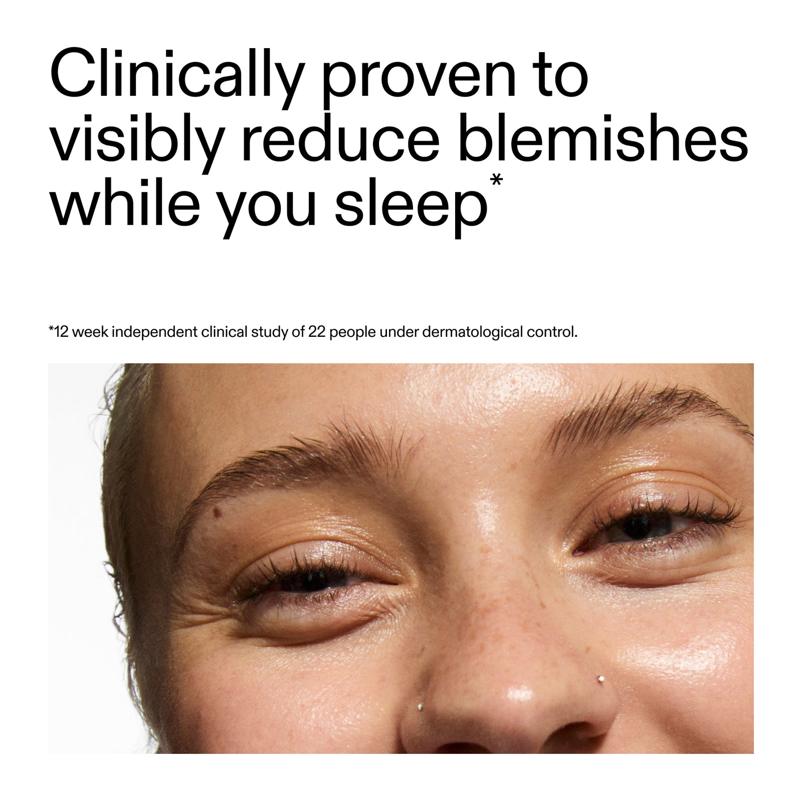 Advertisement for Blemish Clearing Moisturiser with 2% Novoretin showing a close-up of a person's eye with text claiming clinical provenance from a clinical study