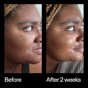 Before and after results using The INKEY List Omega Water Cream after 2 weeks