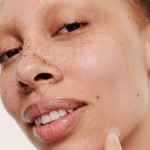 Model with Pimple Patch