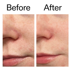 Before and after showing blemish gone