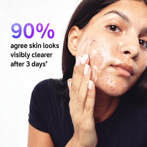 Image of model cleansing face with text overlay that reads '90% agree skin looks visibly clearer after 3 days*'