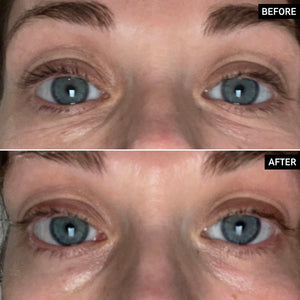 Brighten-i Eye Cream before and after
