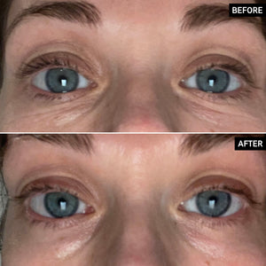 Before and after comparison of a person's eyes with visible changes.