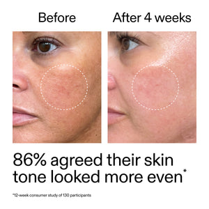Before and after comparison of skin tone with text indicating improvement and study details.