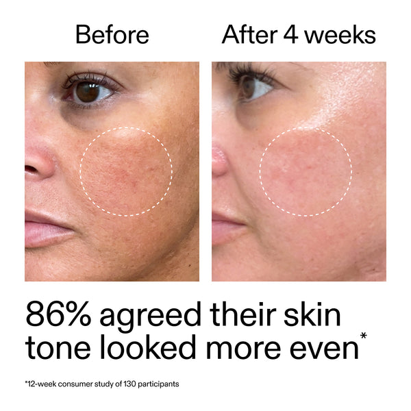 Gentle Starter Retinol for Sensitive Skin | 7-Day Results | The INKEY List