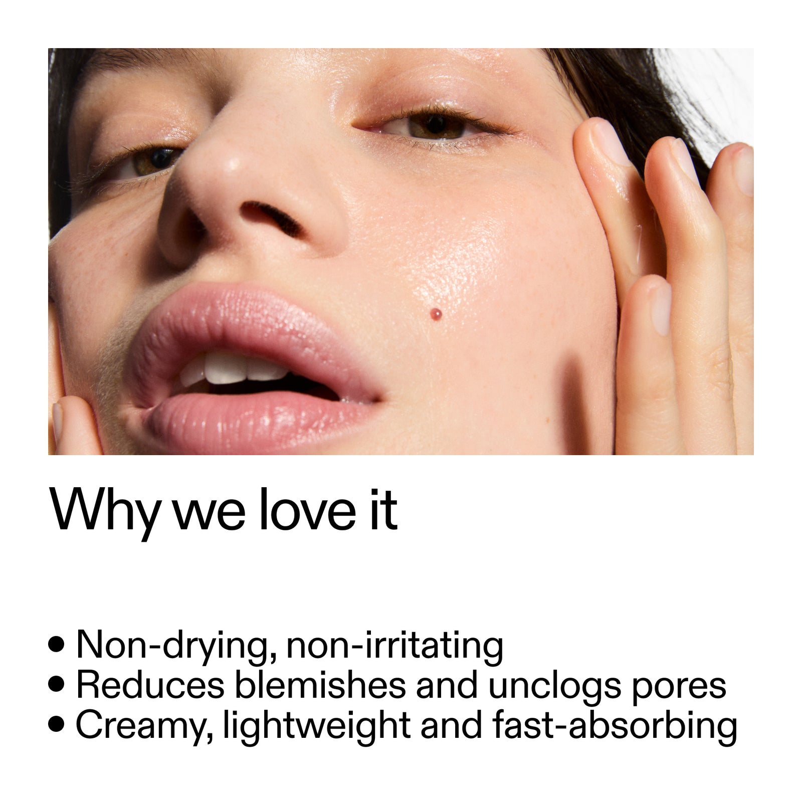 Close-up of a person's face with text highlighting Succinic Acid Treatment benefits