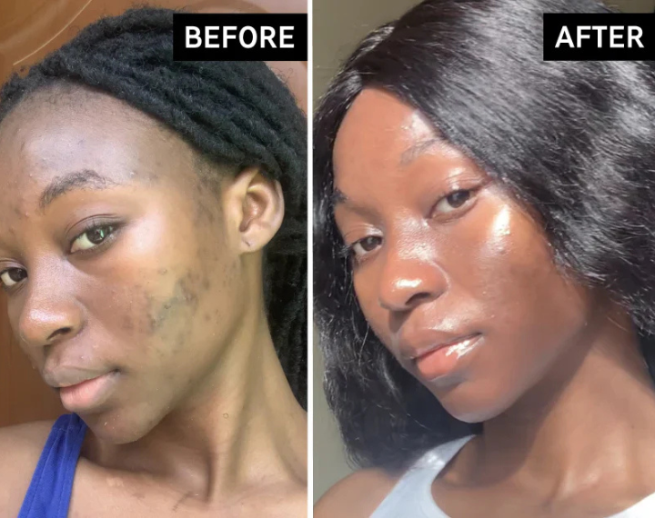 Before and after of customer