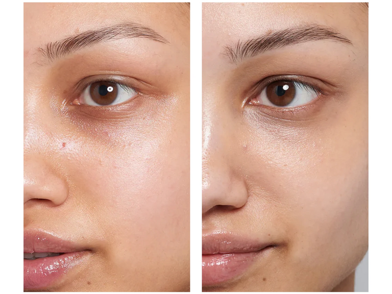Before and after comparison of a face with a focus on the eye area.