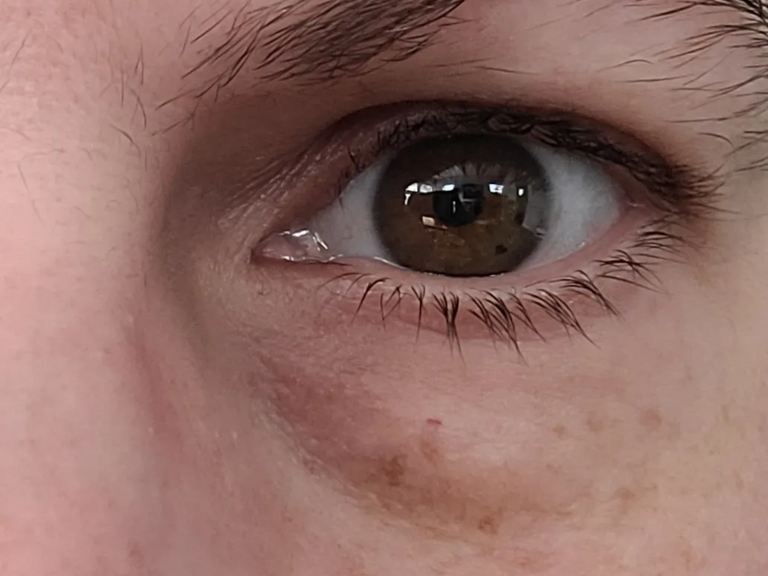 Close-up of a brown eye with visible eyelashes and skin texture.