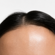 Close up of forehead and scalp