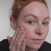 woman applying Azealic acid