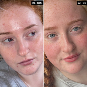 Before and After of customer using Vitamin B, C and E Moisturizer