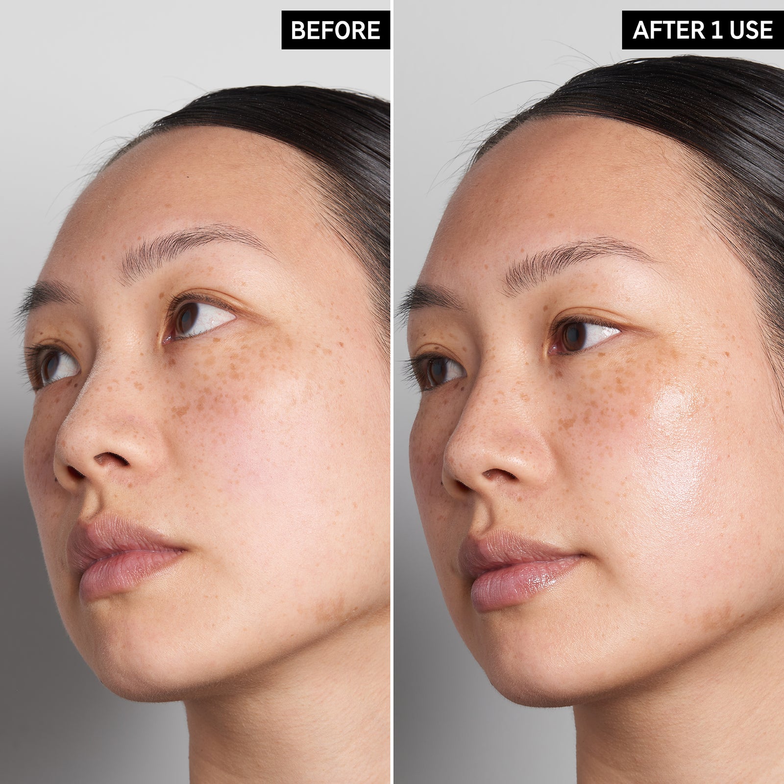 2 images of a model's face side by side to show the before and after using Hyaluronic Acid Serum just once