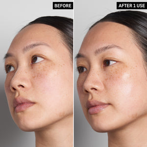 Two images of a model's face to show before and after using Supersize Hyaluronic Acid Serum just once