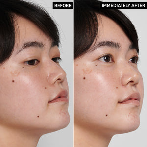 2 images of a model's face side by side to show before and immediately after using Hyaluronic Acid Cleanser