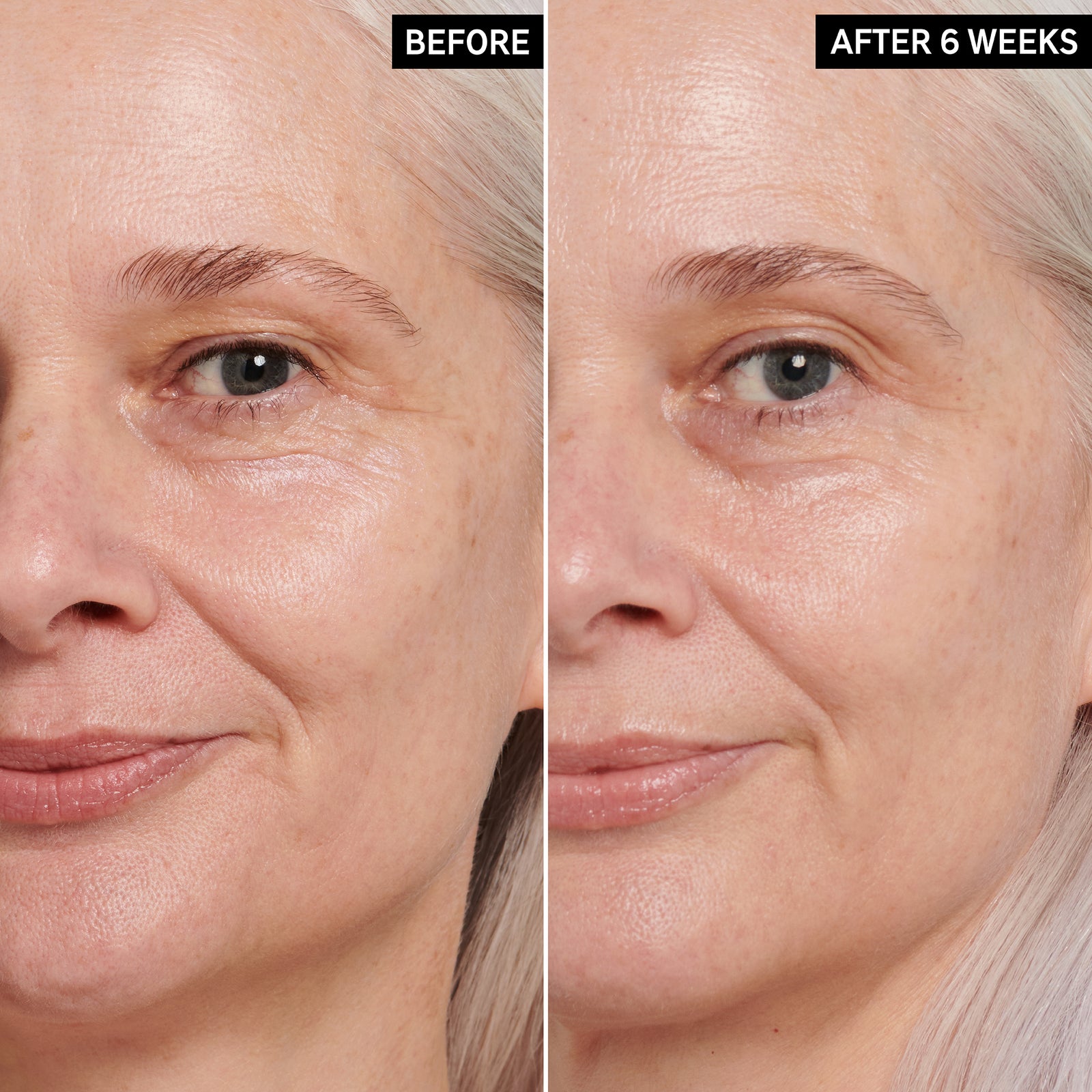 2 images of a mature model's face side by side to show before and after using Retinol Eye Cream for 6 weeks