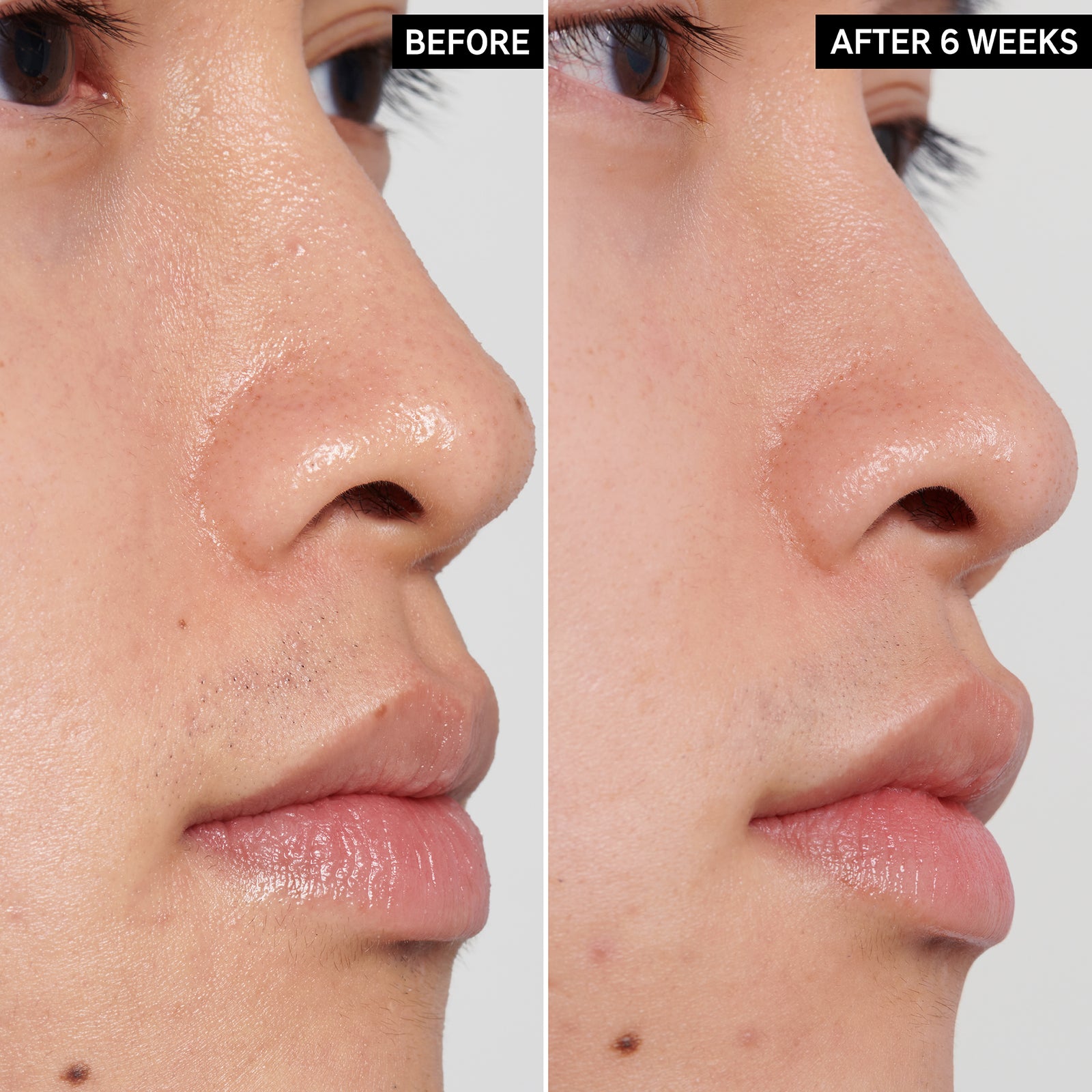 2 images of a model's face side by side to show before and after using PHA Toner for 6 weeks